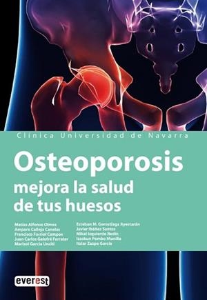 OSTEOPOROSIS, MEJORA LA SALUD DE TUS HUESOS | 9788424184315 | VV.AA. | Llibreria Aqualata | Comprar libros en catalán y castellano online | Comprar libros Igualada