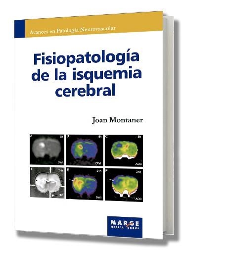 FISIOPATOLOGIA DE LA ISQUEMIA CEREBRAL | 9788486684839 | MONTANER, JOAN | Llibreria Aqualata | Comprar llibres en català i castellà online | Comprar llibres Igualada