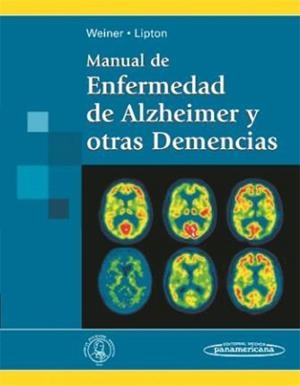 MANUAL DE ENFERMEDAD DE ALZHEIMER Y OTRAS DEMENCIAS | 9788498353228 | WEINER MD, MYRON | Llibreria Aqualata | Comprar libros en catalán y castellano online | Comprar libros Igualada